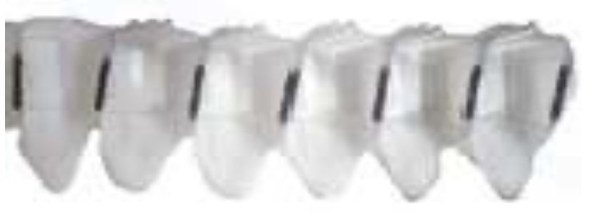 KIT 10 GODETS GAUCHES 3 TROUS