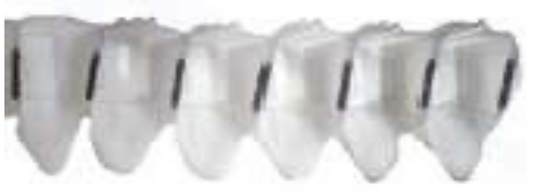 KIT 10 GODETS GAUCHES 3 TROUS